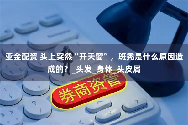 亚金配资 头上突然“开天窗”，斑秃是什么原因造成的？_头发_身体_头皮屑